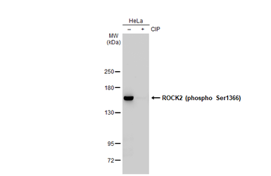 Anti-ROCK2 (phospho Ser1366) antibody [HL1071] used in Western Blot (WB). GTX636103