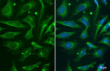 Anti-ROCK2 (phospho Ser1366) antibody [HL1071] used in Immunocytochemistry/ Immunofluorescence (ICC/IF). GTX636103