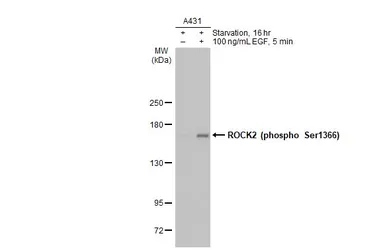Anti-ROCK2 (phospho Ser1366) antibody [HL1071] used in Western Blot (WB). GTX636103