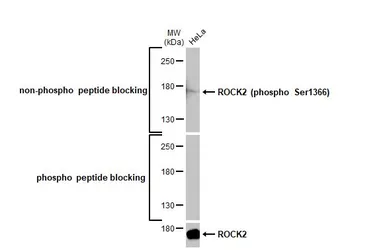 Anti-ROCK2 (phospho Ser1366) antibody [HL1071] used in Western Blot (WB). GTX636103