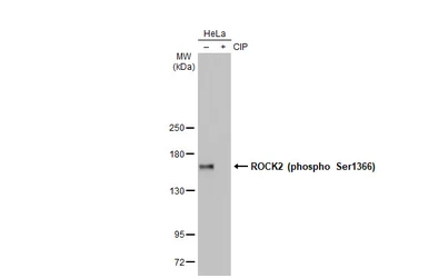 Anti-ROCK2 (phospho Ser1366) antibody [HL1071] used in Western Blot (WB). GTX636103