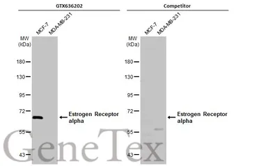 Anti-Estrogen Receptor alpha antibody [HL1081] used in Western Blot (WB). GTX636202