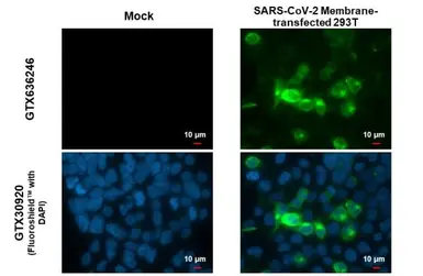 Anti-SARS-CoV-2 (COVID-19) Membrane antibody [HL1088] used in Immunocytochemistry/ Immunofluorescence (ICC/IF). GTX636246