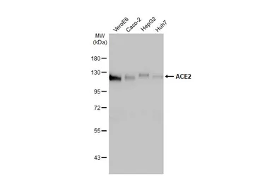 Anti-ACE2 antibody [HL1092] used in Western Blot (WB). GTX636265