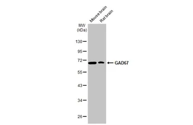 Anti-GAD67 antibody [HL1095] used in Western Blot (WB). GTX636279