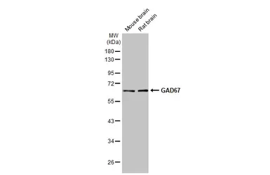 Anti-GAD67 antibody [HL1095] used in Western Blot (WB). GTX636279