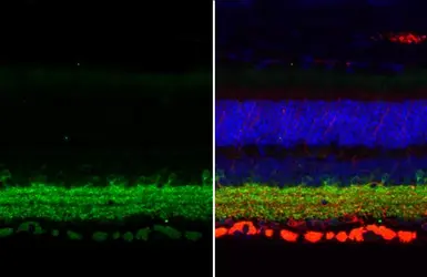 Anti-GAD67 antibody [HL1096] used in IHC (Paraffin sections) (IHC-P). GTX636280