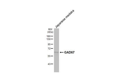Anti-GAD67 antibody [HL1096] used in Western Blot (WB). GTX636280