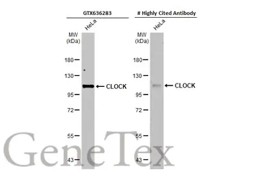 Anti-CLOCK antibody [HL1099] used in Western Blot (WB). GTX636283