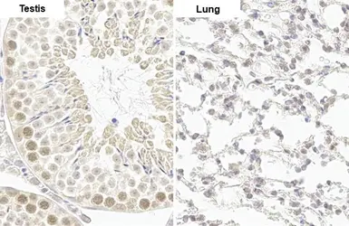 Anti-CLOCK antibody [HL1099] used in IHC (Paraffin sections) (IHC-P). GTX636283