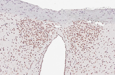 Anti-CLOCK antibody [HL1099] used in IHC (Paraffin sections) (IHC-P). GTX636283