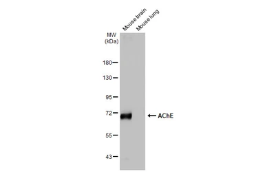 Anti-AChE antibody [HL1102] used in Western Blot (WB). GTX636298