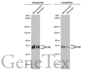 Anti-AChE antibody [HL1102] used in Western Blot (WB). GTX636298