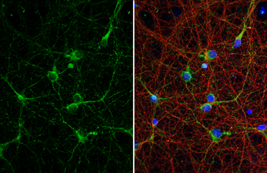 Anti-AChE antibody [HL1102] used in Immunocytochemistry/ Immunofluorescence (ICC/IF). GTX636298