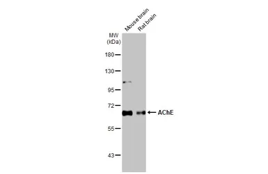 Anti-AChE antibody [HL1102] used in Western Blot (WB). GTX636298