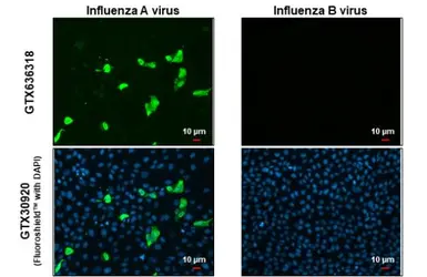 Anti-Influenza A virus Nucleoprotein antibody [HL1103] used in Immunocytochemistry/ Immunofluorescence (ICC/IF). GTX636318