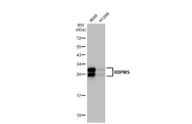 Anti-RBPMS antibody [HL1106] used in Western Blot (WB). GTX636321