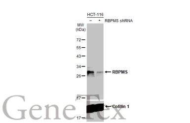 Anti-RBPMS antibody [HL1106] used in Western Blot (WB). GTX636321