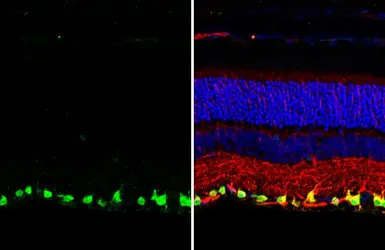 Anti-RBPMS antibody [HL1106] used in IHC (Paraffin sections) (IHC-P). GTX636321