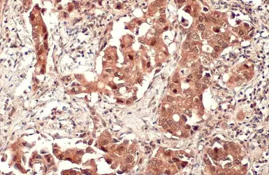Anti-SQSTM1 / P62 antibody [HL1113] used in IHC (Paraffin sections) (IHC-P). GTX636328