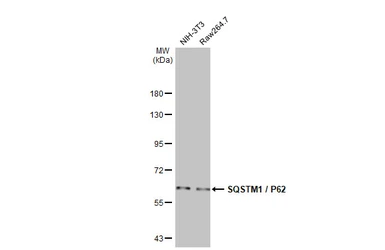 Anti-SQSTM1 / P62 antibody [HL1113] used in Western Blot (WB). GTX636328