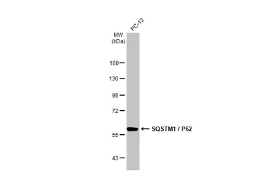 Anti-SQSTM1 / P62 antibody [HL1113] used in Western Blot (WB). GTX636328