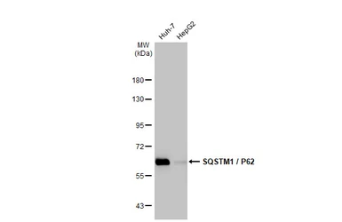 Anti-SQSTM1 / P62 antibody [HL1113] used in Western Blot (WB). GTX636328