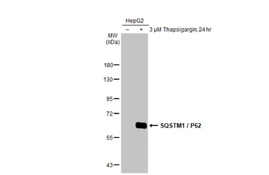 Anti-SQSTM1 / P62 antibody [HL1113] used in Western Blot (WB). GTX636328