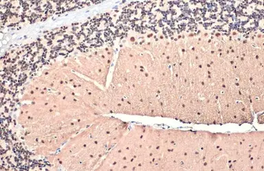 Anti-SMARCA2 antibody [HL1114] used in IHC (Paraffin sections) (IHC-P). GTX636329