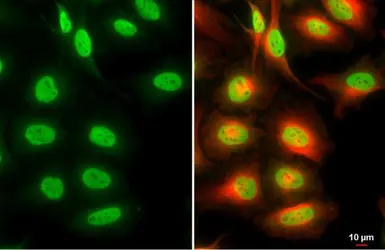 Anti-SMARCA2 antibody [HL1114] used in Immunocytochemistry/ Immunofluorescence (ICC/IF). GTX636329