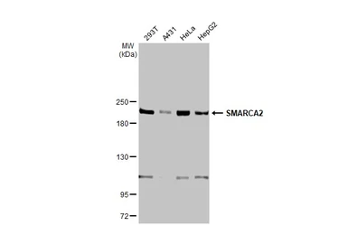 Anti-SMARCA2 antibody [HL1114] used in Western Blot (WB). GTX636329