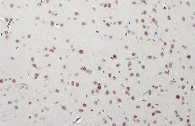 Anti-SMARCA2 antibody [HL1115] used in IHC (Paraffin sections) (IHC-P). GTX636330