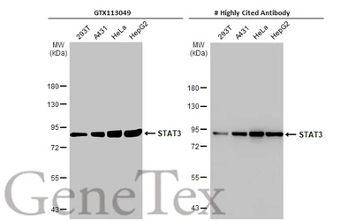 Anti-STAT3 antibody [HL1134] used in Western Blot (WB). GTX636400