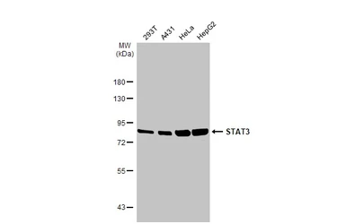 Anti-STAT3 antibody [HL1134] used in Western Blot (WB). GTX636400