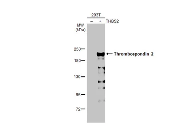 Anti-Thrombospondin 2 antibody [HL1140] used in Western Blot (WB). GTX636411
