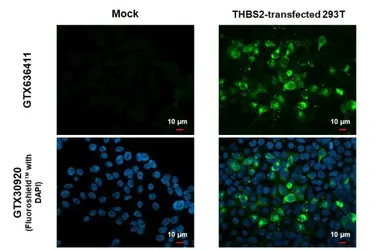 Anti-Thrombospondin 2 antibody [HL1140] used in Immunocytochemistry/ Immunofluorescence (ICC/IF). GTX636411