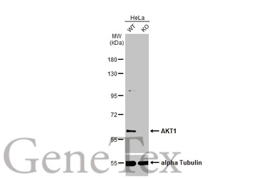 Anti-AKT1 antibody [HL1142] used in Western Blot (WB). GTX636413