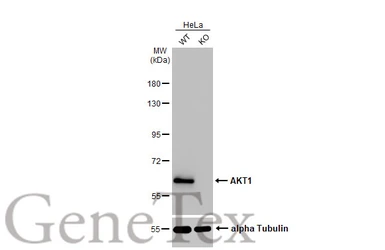 Anti-AKT1 antibody [HL1145] used in Western Blot (WB). GTX636416
