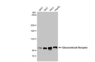 Anti-Glucocorticoid Receptor antibody [HL1149] used in Western Blot (WB). GTX636420