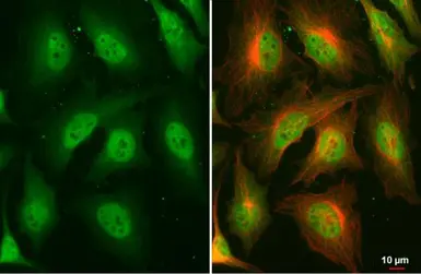 Anti-Glucocorticoid Receptor antibody [HL1149] used in Immunocytochemistry/ Immunofluorescence (ICC/IF). GTX636420