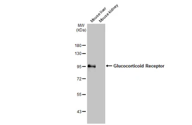 Anti-Glucocorticoid Receptor antibody [HL1149] used in Western Blot (WB). GTX636420