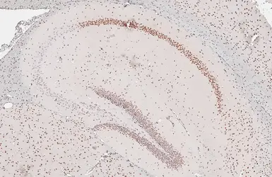 Anti-Glucocorticoid Receptor antibody [HL1149] used in IHC (Paraffin sections) (IHC-P). GTX636420