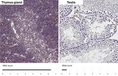 Anti-Glucocorticoid Receptor antibody [HL1149] used in IHC (Paraffin sections) (IHC-P). GTX636420