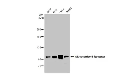 Anti-Glucocorticoid Receptor antibody [HL1151] used in Western Blot (WB). GTX636422