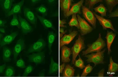 Anti-Glucocorticoid Receptor antibody [HL1151] used in Immunocytochemistry/ Immunofluorescence (ICC/IF). GTX636422
