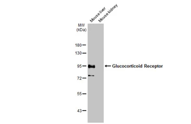 Anti-Glucocorticoid Receptor antibody [HL1151] used in Western Blot (WB). GTX636422