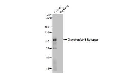 Anti-Glucocorticoid Receptor antibody [HL1151] used in Western Blot (WB). GTX636422