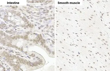 Anti-Glucocorticoid Receptor antibody [HL1151] used in IHC (Paraffin sections) (IHC-P). GTX636422