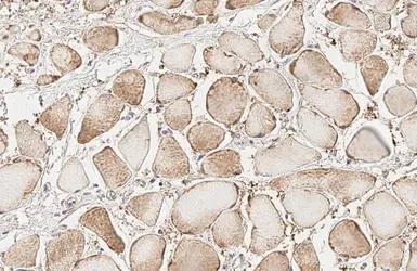 Anti-Glucocorticoid Receptor antibody [HL1151] used in IHC (Paraffin sections) (IHC-P). GTX636422