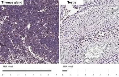 Anti-Glucocorticoid Receptor antibody [HL1151] used in IHC (Paraffin sections) (IHC-P). GTX636422